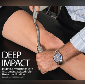 Deep Impact: Targeting restrictions with instrument-assisted soft-tissue mobilization
