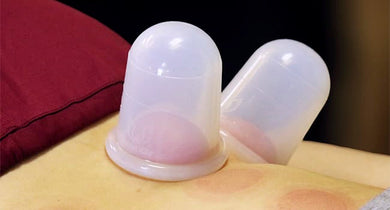 Silicone Cupping Set: Benefits, Techniques & When Clinicians Should Use It