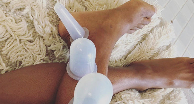 Silicone Cupping Set: Benefits, Techniques & When Clinicians Should Use It