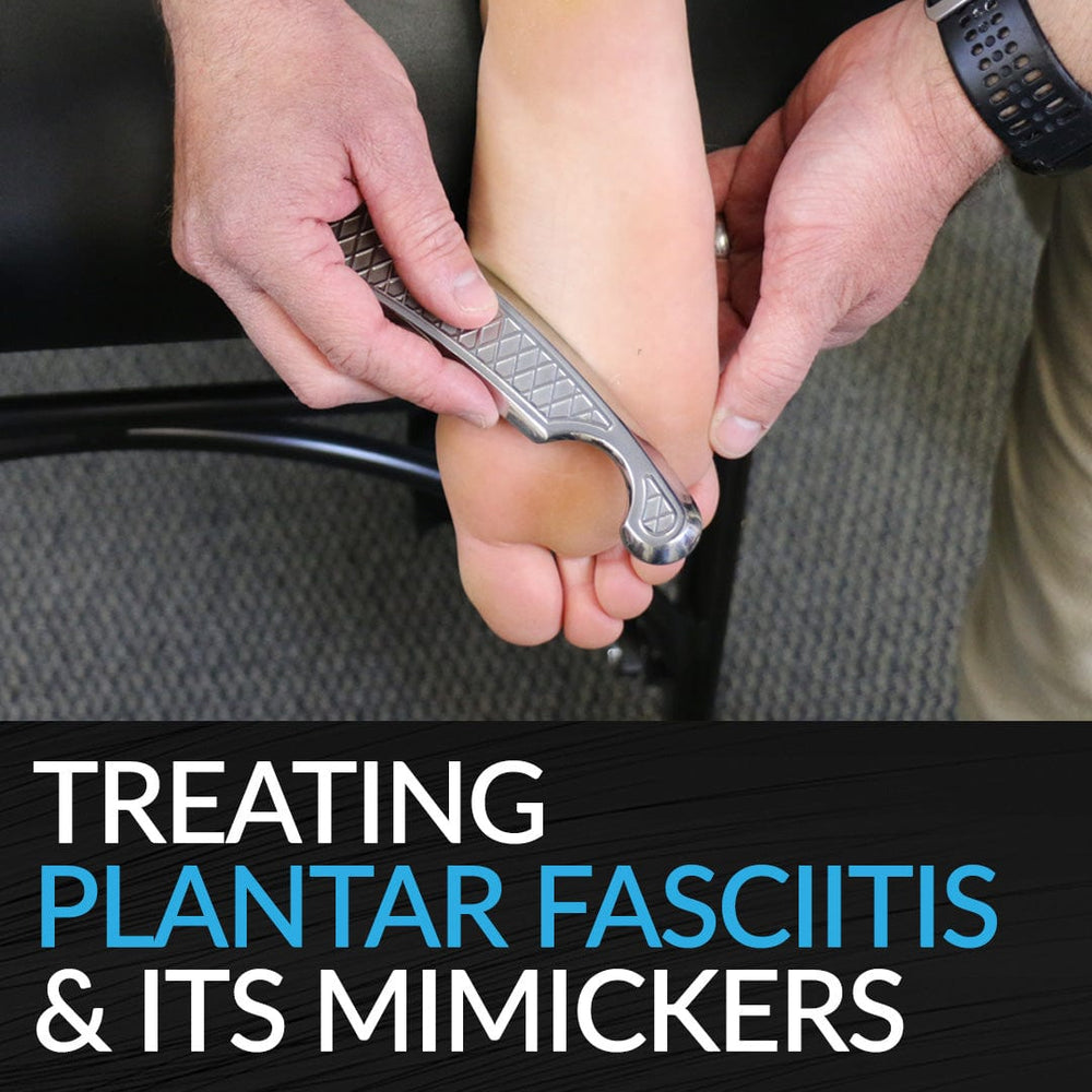 HawkGrips Courses Treating Plantar Fasciitis and Its Mimickers