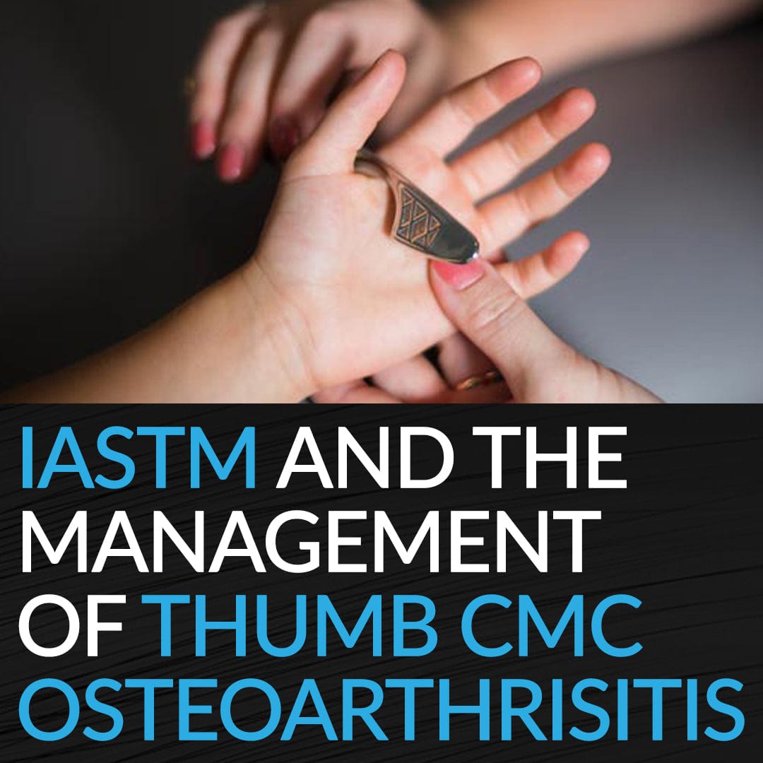 HawkGrips IASTM and the Management of Thumb CMC Osteoarthritis